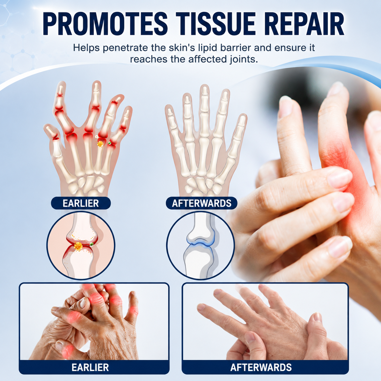 🦴 𝐈𝐂𝐘𝐒𝐓𝐀𝐑® 𝐉𝐨𝐢𝐧𝐭 𝐂𝐚𝐫𝐞 𝐑𝐞𝐥𝐢𝐞𝐟 𝐂𝐫𝐞𝐚𝐦 — 𝟓-𝐢𝐧-𝟏 𝐀𝐝𝐯𝐚𝐧𝐜𝐞𝐝 𝐉𝐨𝐢𝐧𝐭 𝐒𝐮𝐩𝐩𝐨𝐫𝐭 𝐟𝐨𝐫 𝐂𝐨𝐦𝐟𝐨𝐫𝐭, 𝐌𝐨𝐛𝐢𝐥𝐢𝐭𝐲 & 𝐂𝐚𝐫𝐭𝐢𝐥𝐚𝐠𝐞 𝐂𝐚𝐫𝐞