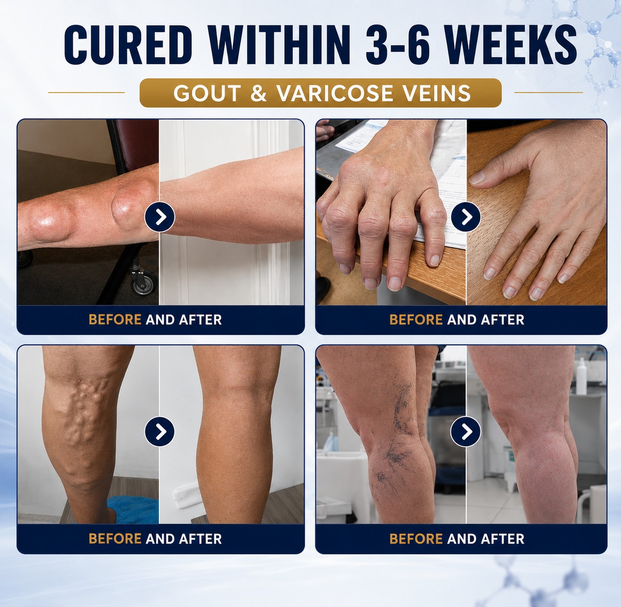 🦴 𝐈𝐂𝐘𝐒𝐓𝐀𝐑® 𝐉𝐨𝐢𝐧𝐭 𝐂𝐚𝐫𝐞 𝐑𝐞𝐥𝐢𝐞𝐟 𝐂𝐫𝐞𝐚𝐦 — 𝟓-𝐢𝐧-𝟏 𝐀𝐝𝐯𝐚𝐧𝐜𝐞𝐝 𝐉𝐨𝐢𝐧𝐭 𝐒𝐮𝐩𝐩𝐨𝐫𝐭 𝐟𝐨𝐫 𝐂𝐨𝐦𝐟𝐨𝐫𝐭, 𝐌𝐨𝐛𝐢𝐥𝐢𝐭𝐲 & 𝐂𝐚𝐫𝐭𝐢𝐥𝐚𝐠𝐞 𝐂𝐚𝐫𝐞