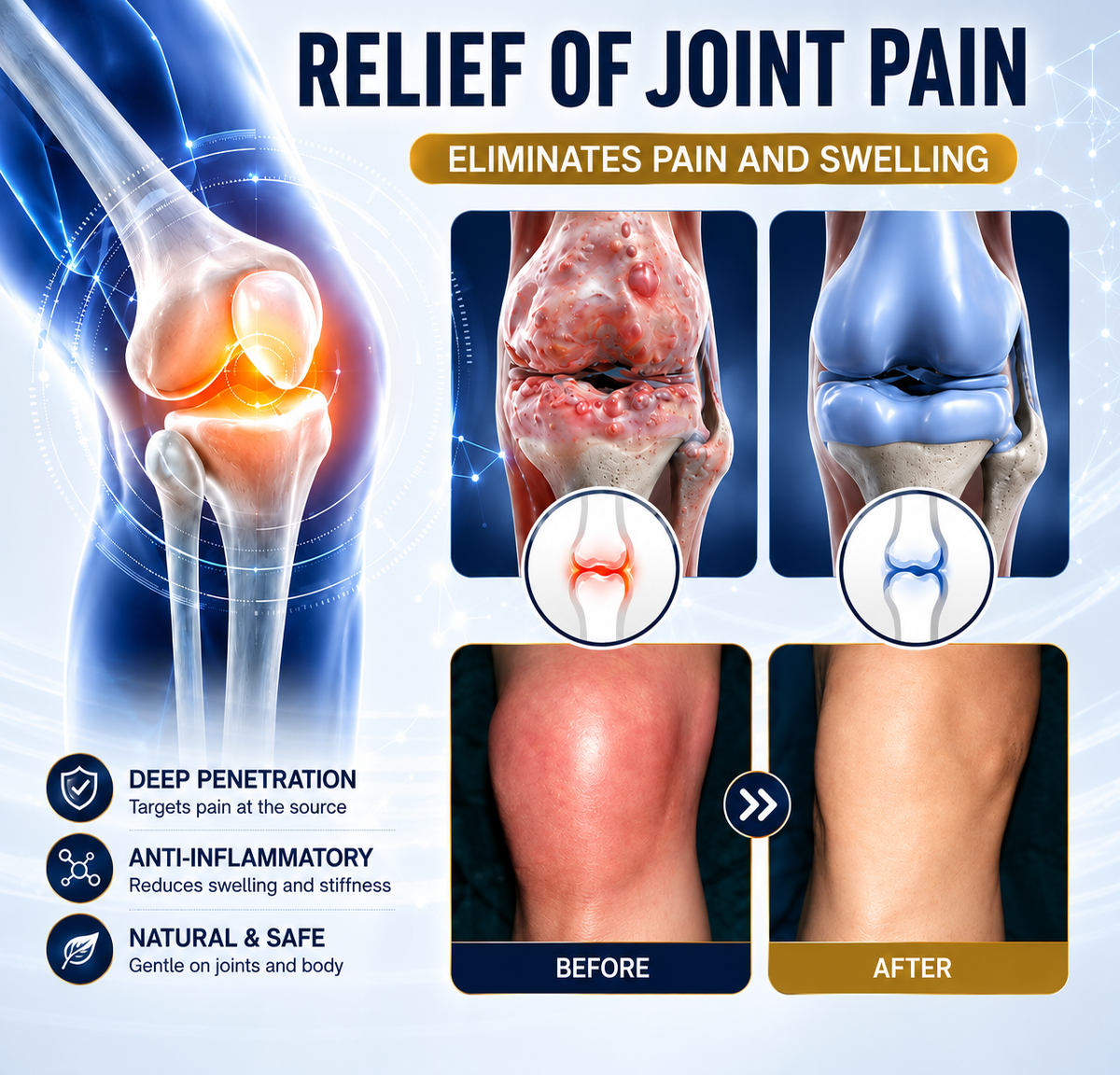🦴 𝐈𝐂𝐘𝐒𝐓𝐀𝐑® 𝐉𝐨𝐢𝐧𝐭 𝐂𝐚𝐫𝐞 𝐑𝐞𝐥𝐢𝐞𝐟 𝐂𝐫𝐞𝐚𝐦 — 𝟓-𝐢𝐧-𝟏 𝐀𝐝𝐯𝐚𝐧𝐜𝐞𝐝 𝐉𝐨𝐢𝐧𝐭 𝐒𝐮𝐩𝐩𝐨𝐫𝐭 𝐟𝐨𝐫 𝐂𝐨𝐦𝐟𝐨𝐫𝐭, 𝐌𝐨𝐛𝐢𝐥𝐢𝐭𝐲 & 𝐂𝐚𝐫𝐭𝐢𝐥𝐚𝐠𝐞 𝐂𝐚𝐫𝐞